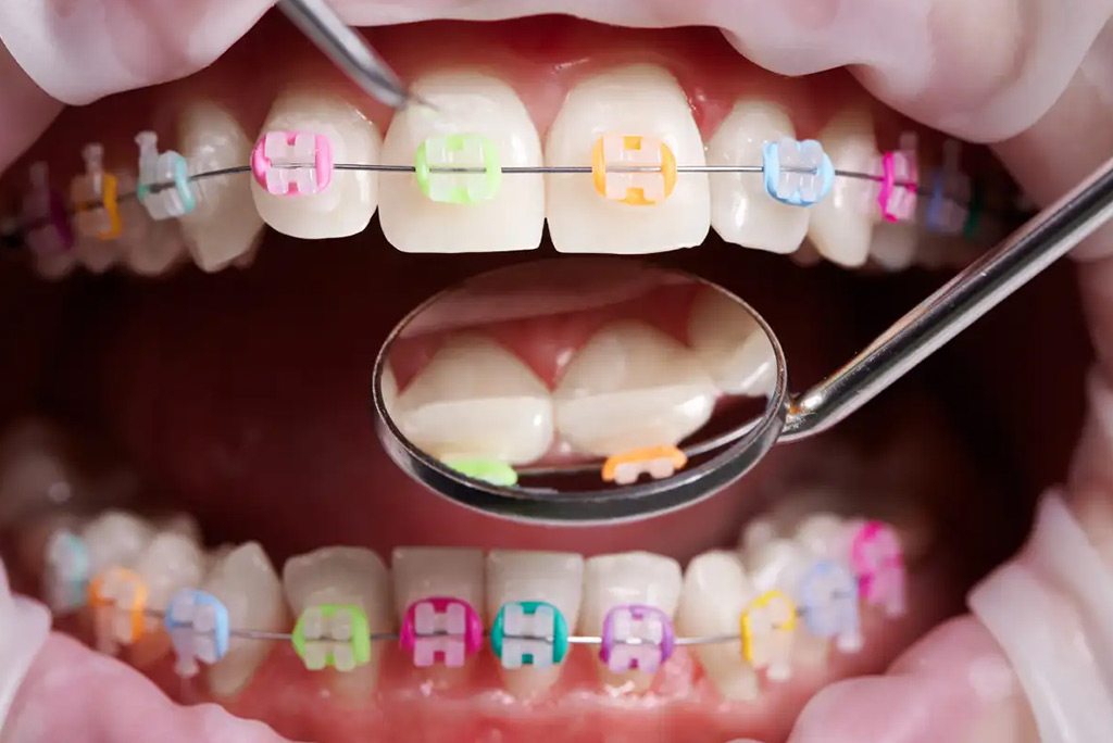 Braces evolution timeline displayed at Tooth Fairy Dental on Eglinton's Midtown Toronto office